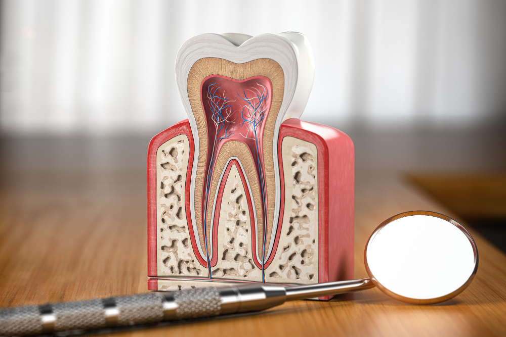 Root Canals in Deer Park